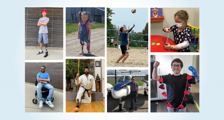collage of prosthetics clients